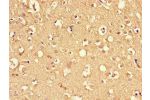 Immunohistochemistry of paraffin-embedded human brain tissue using CSB-PA007040LA01HU at dilution of 1:100