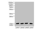 Western blot<br />
All lanes: DNAL4 antibody at 1.5ug/ml<br />
Lane 1 : Mouse gonadal tissue<br />
Lane 2 : HL60 whole cell lysate<br />
Lane 3 : NIH/3T3 whole cell lysate<br />
Lane 4 : Mouse brain tissue<br />
Secondary<br />
Goat polyclonal to Rabbit I