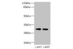 Western blot<br />
All lanes: DNALI1 antibody at 1ug/ml<br />
Lane 1 : Mouse gonadal tissue<br />
Lane 2 : Mouse lung tissue<br />
Secondary<br />
Goat polyclonal to Rabbit IgG at 1/10000 dilution<br />
Predicted band size: 30,16 kDa<br />
Observed band s
