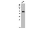 Western Blot analysis of HT-29 cells using CB1 Polyclonal Antibody
