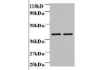 Western blot<br />
All lanes: Beta-1,4-galactosyltransferase 3 antibody at 2ug/ml<br />
Lane 1 : EC109 whole cell lysate<br />
Lane 2 : 293T whole cell lysate<br />
Secondary<br />
Goat polyclonal to Rabbit IgG at 1/15000 dilution<br />
Predicted band siz