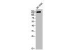 Western Blot analysis of SH-SY5Y cells using COL4A2 Polyclonal Antibody