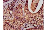 Immunocytochemistry analysis of human brain tissue using CSB-PA007078EA01HU at dilution of 1:100