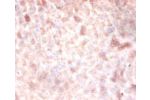 Immunohistochemistry of paraffin-embedded mouse liver using CSB-PA007083la01HU at dilution of 1:100