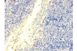 Immunohistochemistry of paraffin-embedded human thymus tissue using CSB-PA007088LA01HU at dilution of 1:100