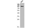 Western Blot analysis of K562 cells using COL6A2 Polyclonal Antibody