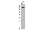 Western Blot analysis of HepG2 cells using COL9A1 Polyclonal Antibody