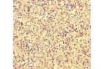 Immunohistochemistry of paraffin-embedded human spleen tissue using CSB-PA007108LA01HU at dilution of 1:100