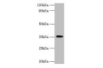 Western blot<br />
All lanes:Docking protein 5 antibody at 2ug/ml+mouse kidney tissue<br />
Secondary<br />
Goat polyclonal to Rabbit IgG at 1/15000 dilution<br />
Predicted band size: 36,23 kDa<br />
Observed band size: 35 kDa<br />