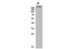 Western Blot analysis of KB cells using COL11A1 Polyclonal Antibody