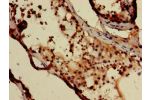 Immunohistochemistry of paraffin-embedded human testis tissue using CSB-PA007116LA01HU at dilution of 1:100