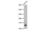 Western Blot<br />
Positive WB detected in:Mouse kidney tissue<br />
All lanes:DPPA5 antibody at 4.6