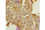 Immunohistochemistry of paraffin-embedded human pancreatic tissue using CSB-PA007156ESR1HU at dilution of 1:100