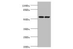 Western blot<br />
All lanes:DPYS antibody at 1.1ug/ml<br />
Lane 1:mouse liver tissue<br />
Lane 2:mouse kidney tissue<br />
Secondary<br />
Goat polyclonal to rabbit at 1/10000 dilution<br />
Predicted band size: 57kDa<br />
Observed band size: 57kDa<br