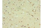 Immunohistochemistry of paraffin-embedded human brain using CSB-PA007180ESR1HU at dilution 1:100