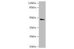 Western blot<br />
All lanes:DRD5 antibody at 2ug/ml+mouse brain tissue<br />
Secondary<br />
Goat polyclonal to rabbit at 1/10000 dilution<br />
Predicted band size: 53kDa<br />
Observed band size: 53kDa<br />