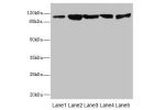 Western blot<br />
All lanes: DSC2 antibody at 3.46ug/ml<br />
Lane 1 : Rat heart tissue<br />
Lane 2 : A549 whole cell lysate<br />
Lane 3 : HepG-2 whole cell lysate<br />
Lane 4 : Jurkat whole cell lysate<br />
Lane 5 : 293T whole cell lysate<br />
Seco