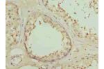 Immunohistochemistry of paraffin-embedded human testis tissue using CSB-PA007200LA01HU at dilution of 1:100