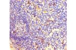 Immunohistochemistry of paraffin-embedded human tonsil tissue using CSB-PA007205LA01HU at dilution of 1:100