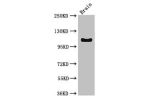 Western Blot<br />
Positive WB detected in:Mouse brain tissue<br />
All lanes:DSG3 antibody at 3