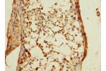 Immunohistochemistry of paraffin-embedded human testis tissue using CSB-PA007213ESR2HU at dilution 1:100