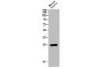 Western Blot analysis of mouse-BRAIN cells using Claudin-4 Polyclonal Antibody