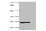 Western blot<br />
All lanes:DTYMK antibody at 5.15ug/ml<br />
Lane 1:Hela whole cell lysate<br />
Lane 2:HepG2 whole cell lysate<br />
Lane 3:rat gonad tissue<br />
Secondary<br />
Goat polyclonal to rabbit at 1/10000 dilution<br />
Predicted band size: 
