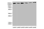 Western blot<br />
All lanes: DUOX2 antibody at 2.18ug/ml<br />
Lane 1 : Mouse lung tissue<br />
Lane 2 : A549 whole cell lysate<br />
Lane 3 : CEM whole cell lysate<br />
Lane 4 : 293T whole cell lysate<br />
Lane 5 : Jurkat whole cell lysate<br />
Lane 