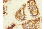 Immunohistochemistry of paraffin-embedded human small intestine using CSB-PA007229ESR2HU at dilution 1:100