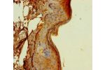 Immunohistochemistry of paraffin-embedded human skin tissue using CSB-PA007237LA01HU at dilution of 1:100
