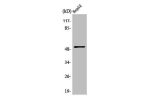 Western Blot analysis of LOVO cells using ATF-2 Polyclonal Antibody