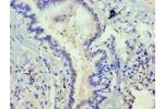 Immunohistochemistry of paraffin-embedded human lung using CSB-PA007286ESR2HU at dilution 1:100