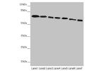 Western blot<br />
All lanes:DYNC1I1 antibody at 2.52 ug/ml<br />
Lane 1 : Mouse brain tissue<br />
Lane 2 : Mouse gonadal tissue<br />
Lane 3 : K562 whole cell lysate<br />
Lane 4 : HL60 whole cell lysate<br />
Lane 5 : Mouse lung tissue<br />
Lane 6 : M