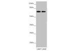 Western blot<br />
All lanes:DYNC1I1 antibody at 1.97 ug/ml<br />
Lane 1 : Mouse brain tissue<br />
Lane 2 : Mouse gonadal tissue<br />
Secondary<br />
Goat polyclonal to rabbit IgG at 1/10000 dilution<br />
Predicted band size: 73,71,69,68 kDa<br />
Obse