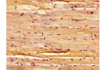 Immunohistochemistry of paraffin-embedded human skeletal muscle tissue using CSB-PA007314LA01HU at dilution of 1:100