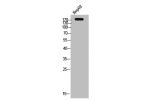 Western Blot analysis of HepG2 cells using c-Fms Polyclonal Antibody