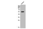 Western Blot analysis of Jurkat cells using Csk Polyclonal Antibody