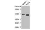 Western Blot<br />
Positive WB detected in:HEK293 whole cell lysate,HepG2 whole cell lysate,Hela whole cell lysate<br />
All lanes: EBI3 antibody at 3ug/ml<br />
Secondary<br />
Goat polyclonal to rabbit IgG at 1/50000 dilution<br />
Predicted band size: 