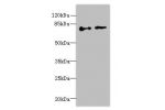 Western blot<br />
All lanes: ECD antibody at 6ug/ml<br />
Lane 1 : Hela whole cell lysate<br />
Lane 2 : U251 whole cell lysate<br />
Secondary<br />
Goat polyclonal to Rabbit IgG at 1/10000 dilution<br />
Predicted band size: 73,68,77 kDa<br />
Observed