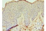 Immunohistochemistry of paraffin-embedded human skin using CSB-PA007371ESR2HU at dilution 1:100