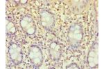 Immunohistochemistry of paraffin-embedded human rectum using CSB-PA007372ESR2HU at dilution 1:100