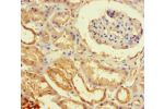 Immunohistochemistry of paraffin-embedded human kidney tissue using CSB-PA007373LA01HU at dilution of 1:100