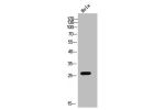 Western Blot analysis of HELA cells using CMTM4 Polyclonal Antibody