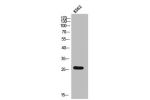 Western Blot analysis of K562 cells using CMTM2 Polyclonal Antibody