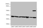 Western blot<br />
All lanes: ECHS1 antibody at 3.03 ug/ml<br />
Lane 1 : Mouse liver tissue<br />
Lane 2 : Mouse skeletal muscle tissue<br />
Lane 3 : Hela whole cell lysate<br />
Lane 4 : HepG-2 whole cell lysate<br />
Lane 5 : MCF7 whole cell lysate<br