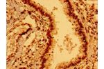 Immunohistochemistry of paraffin-embedded human lung tissue using CSB-PA007385LA01HU at dilution of 1:100