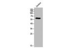 Western Blot analysis of JK cells using AR-a1B Polyclonal Antibody
