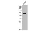 Western Blot analysis of JK cells using AR-a1A Polyclonal Antibody
