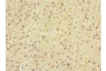 Immunohistochemistry of paraffin-embedded human adrenal gland tissue CSB-PA007399ESR2HU at dilution 1:100