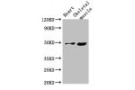 Western Blot<br />
Positive WB detected in:Mouse heart tissue,Mouse skeletal muscle tissue<br />
All lanes:EDNRB antibody at 4